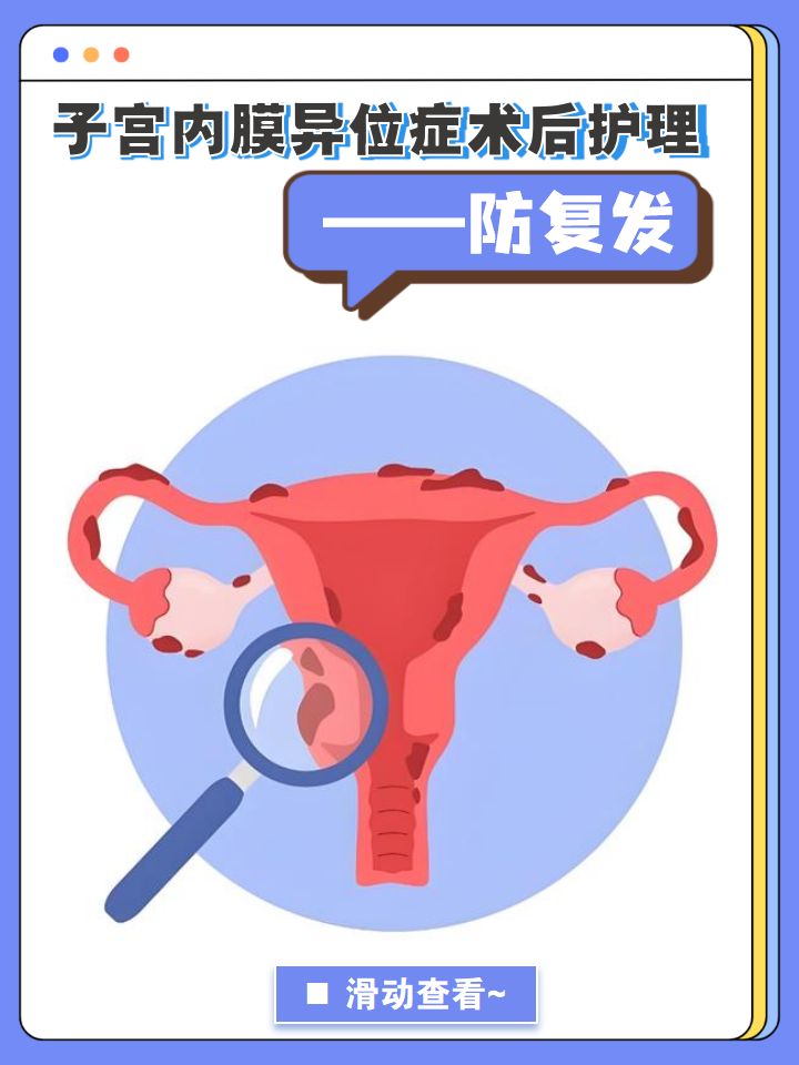 子宫内膜异位症术后护理——防复发