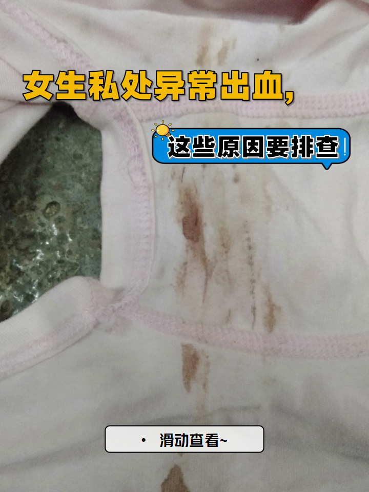 女生私处异常出血,这些原因要排查