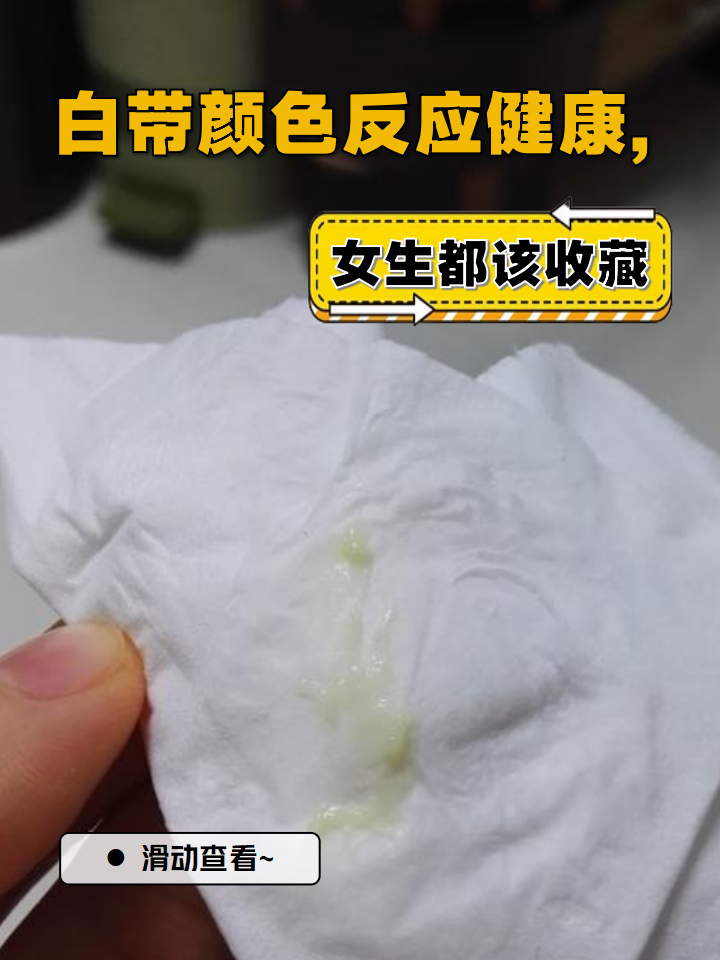 白带颜色反应健康,女生都该收藏