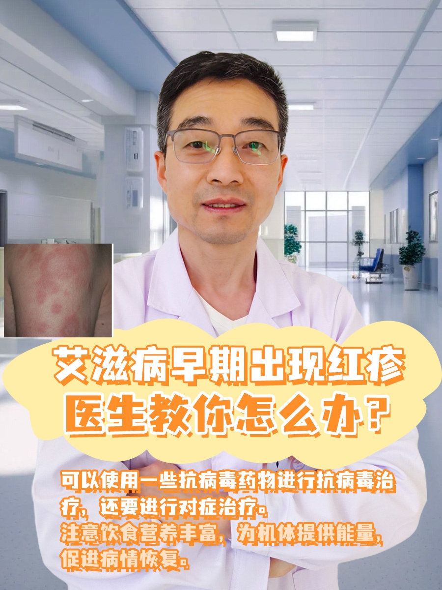 艾滋病早期可以出现红疹,多为斑片状,点状,风团样等.