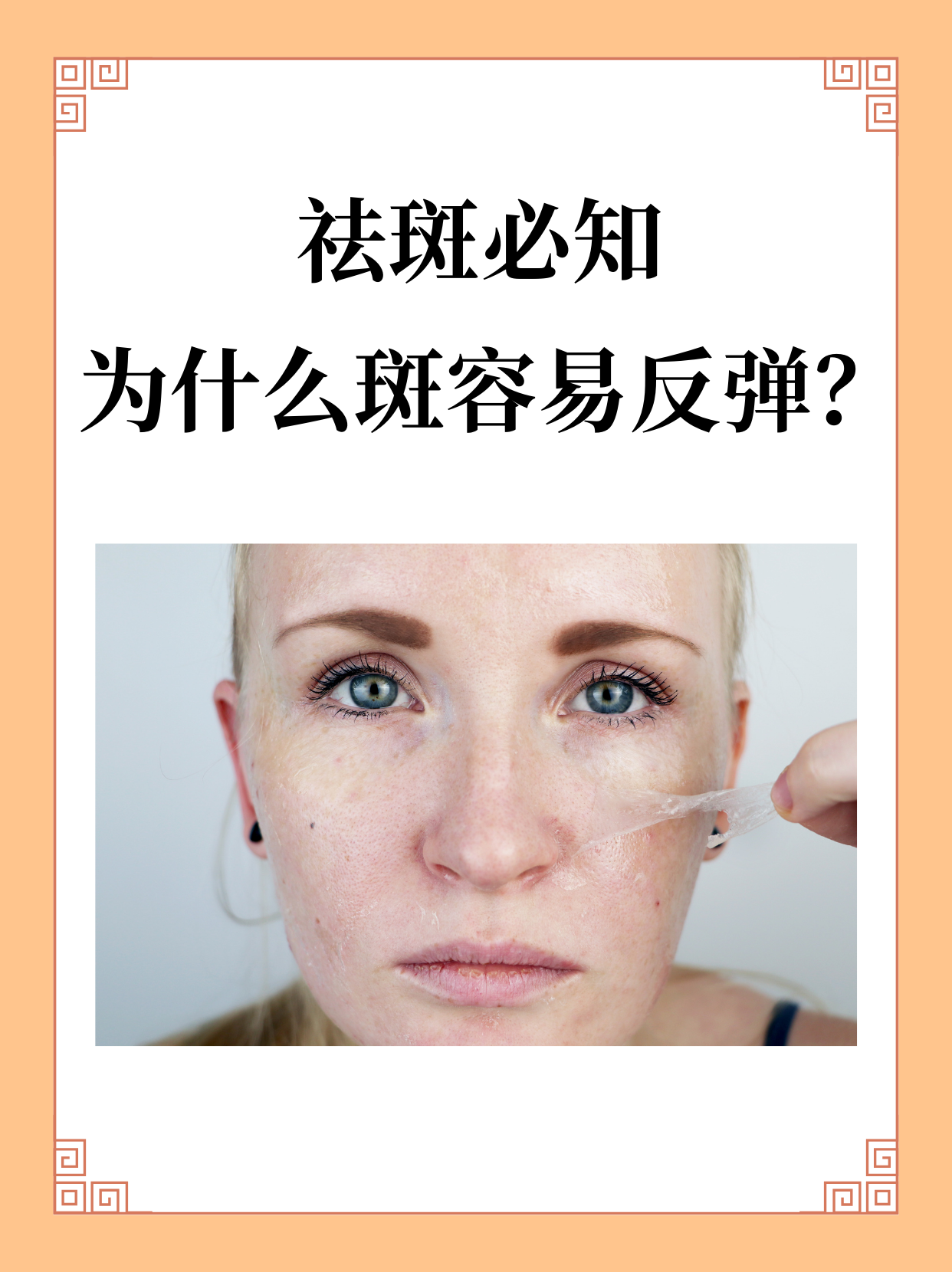 雀斑最怕的克星百科在线
