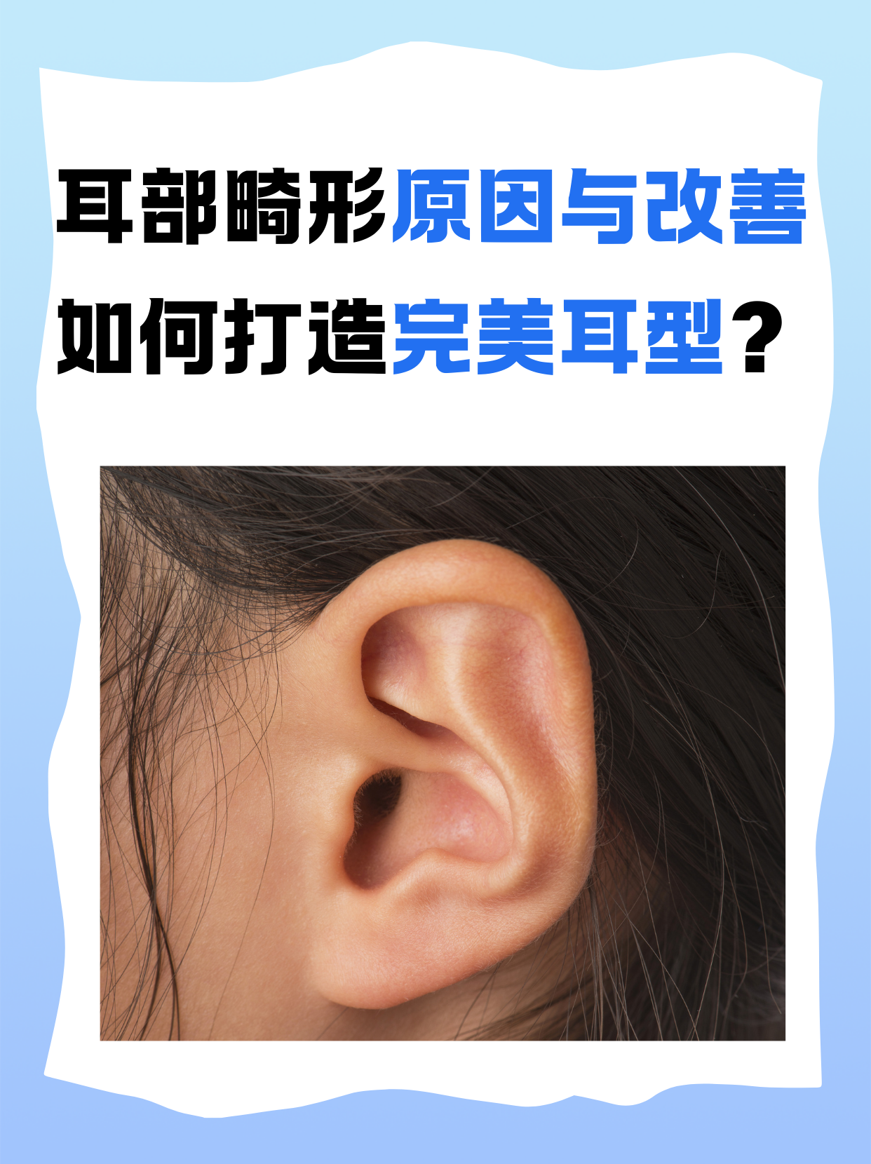 耳部畸形不仅影响外观,还可能对心理造成一定压力