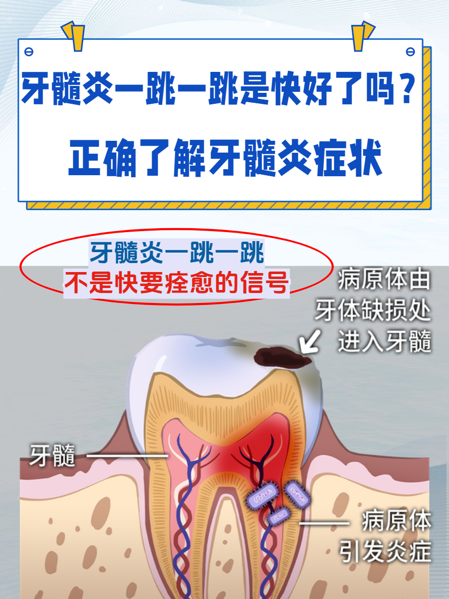 牙髓炎一跳一跳是快好了吗?