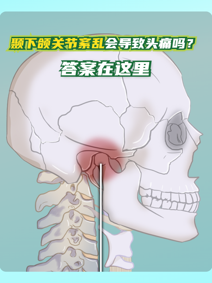 下颌关节紊乱头痛的骨架图脸部骨疼痛脖子会疼吗图片颞下颌关节紊乱病