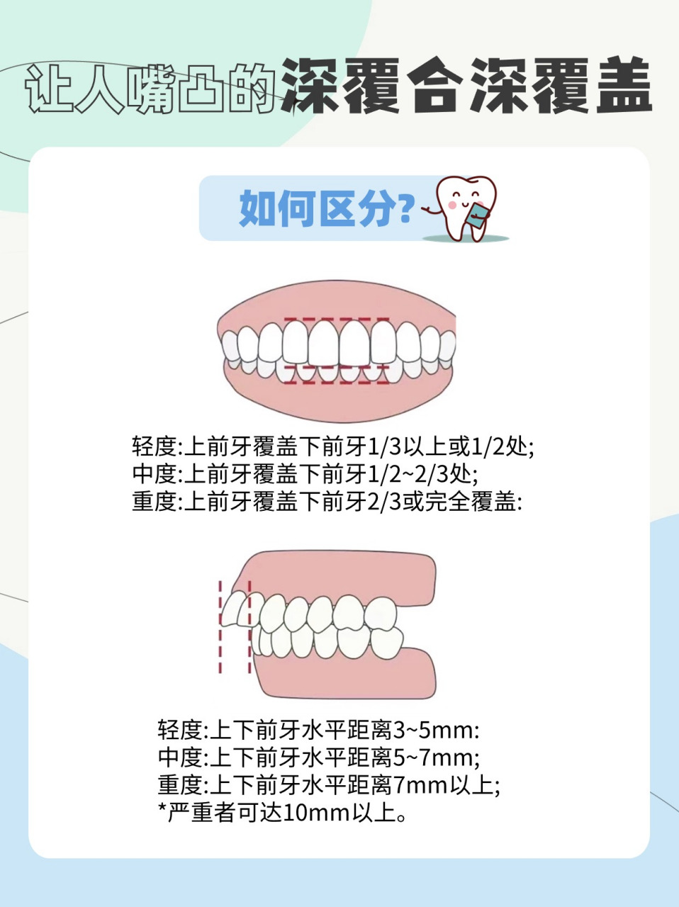 牙齿咬合深覆盖图片