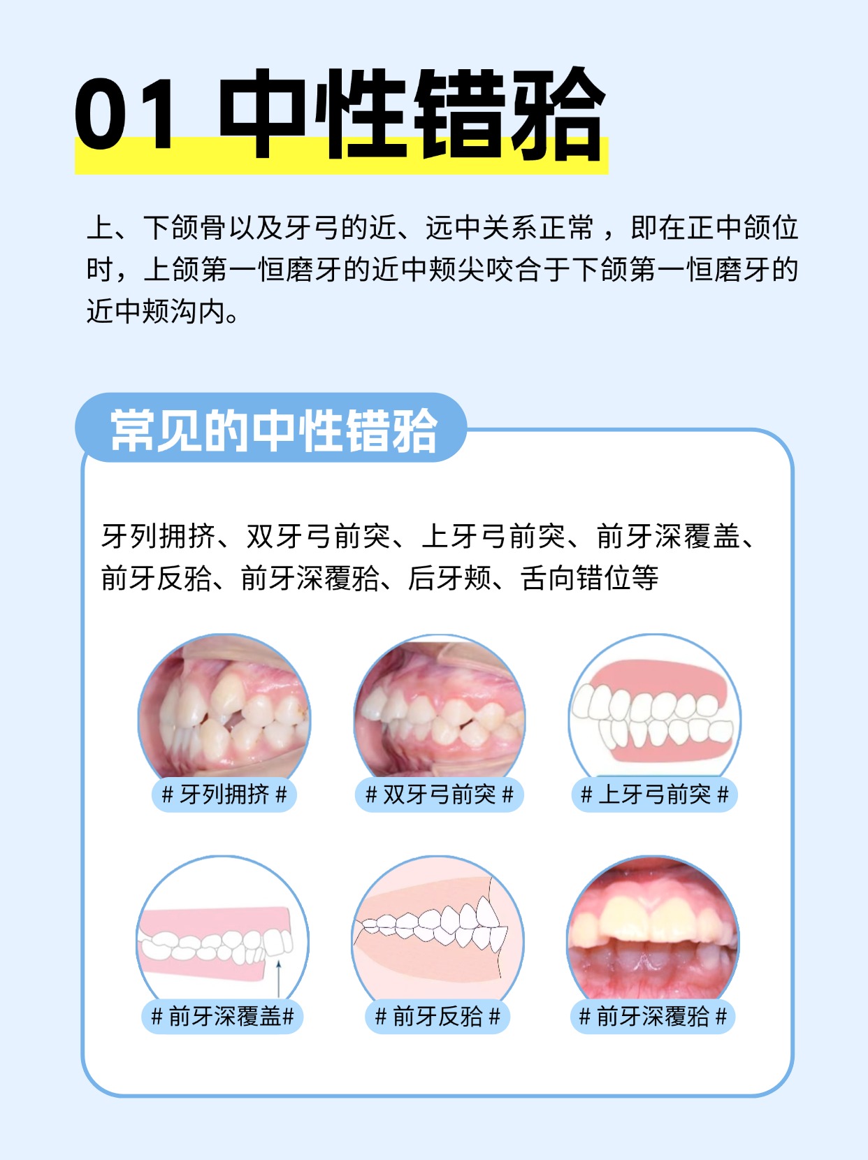 顶颌位的图解图片