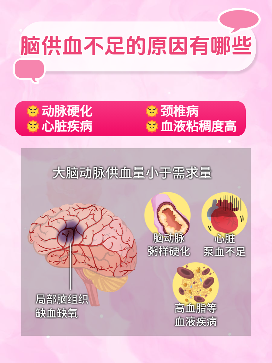 揭秘可能的原因  脑供血不足