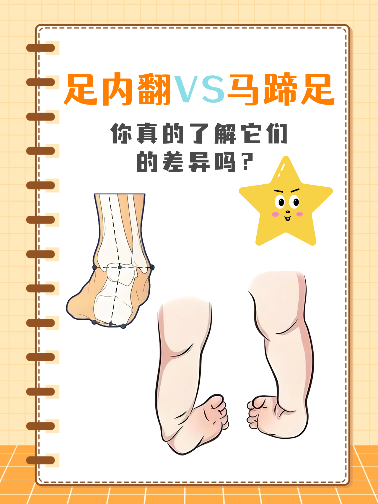 足内翻vs马蹄足:你真的了解它们的差异吗?