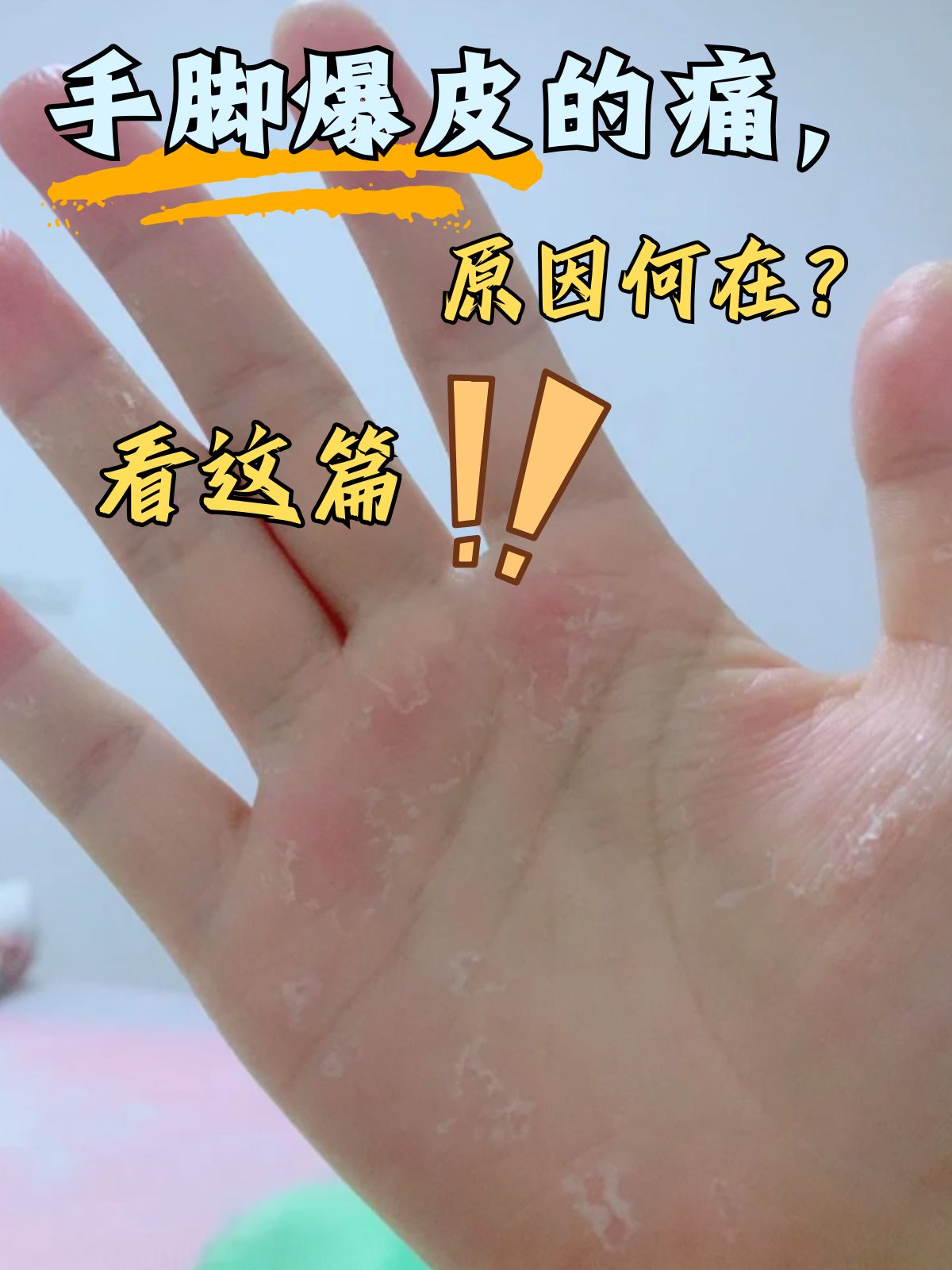 手为什么起皮