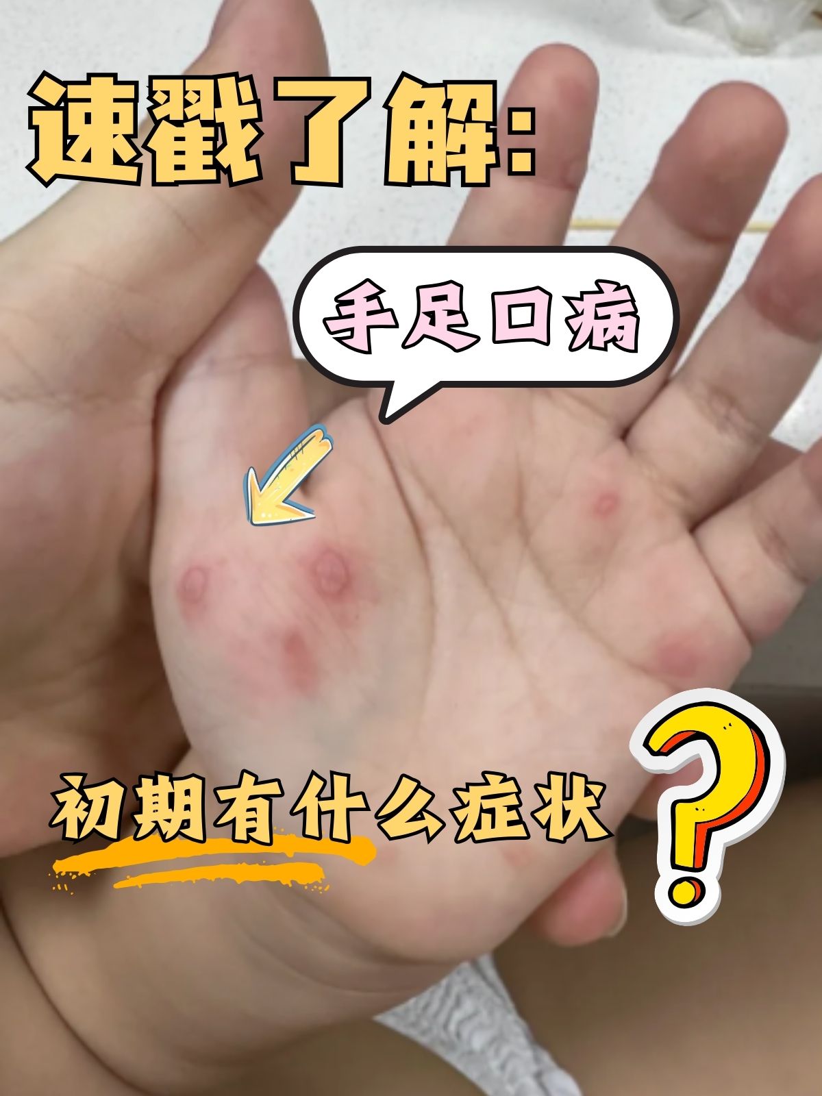 手足指什么代称的