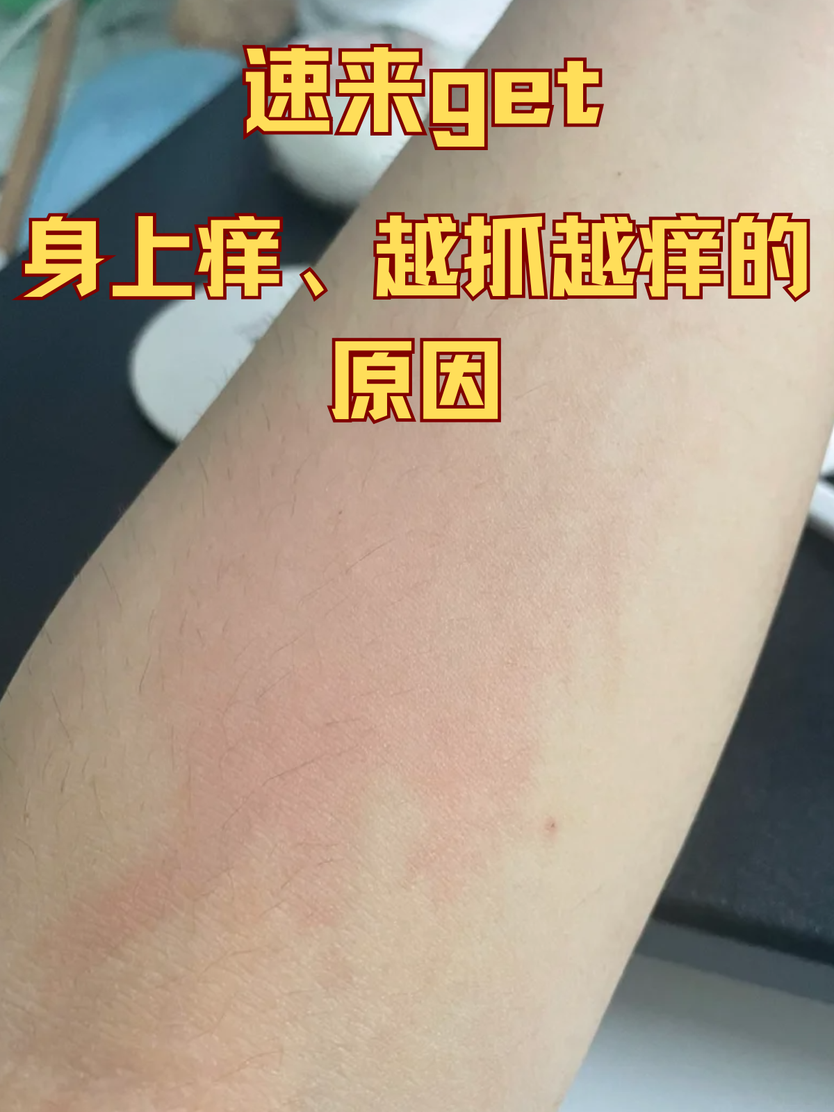 身上为什么会痒 身上为什么会痒