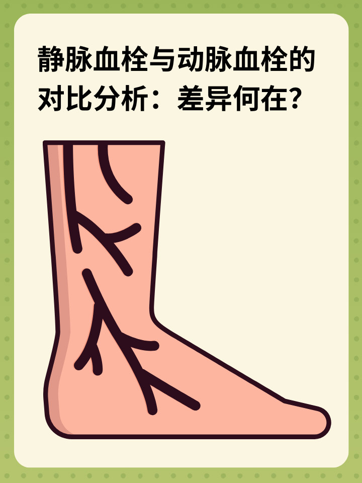 静脉血栓和动脉血栓,两者虽同为血栓却存在于不同的血管系统中.