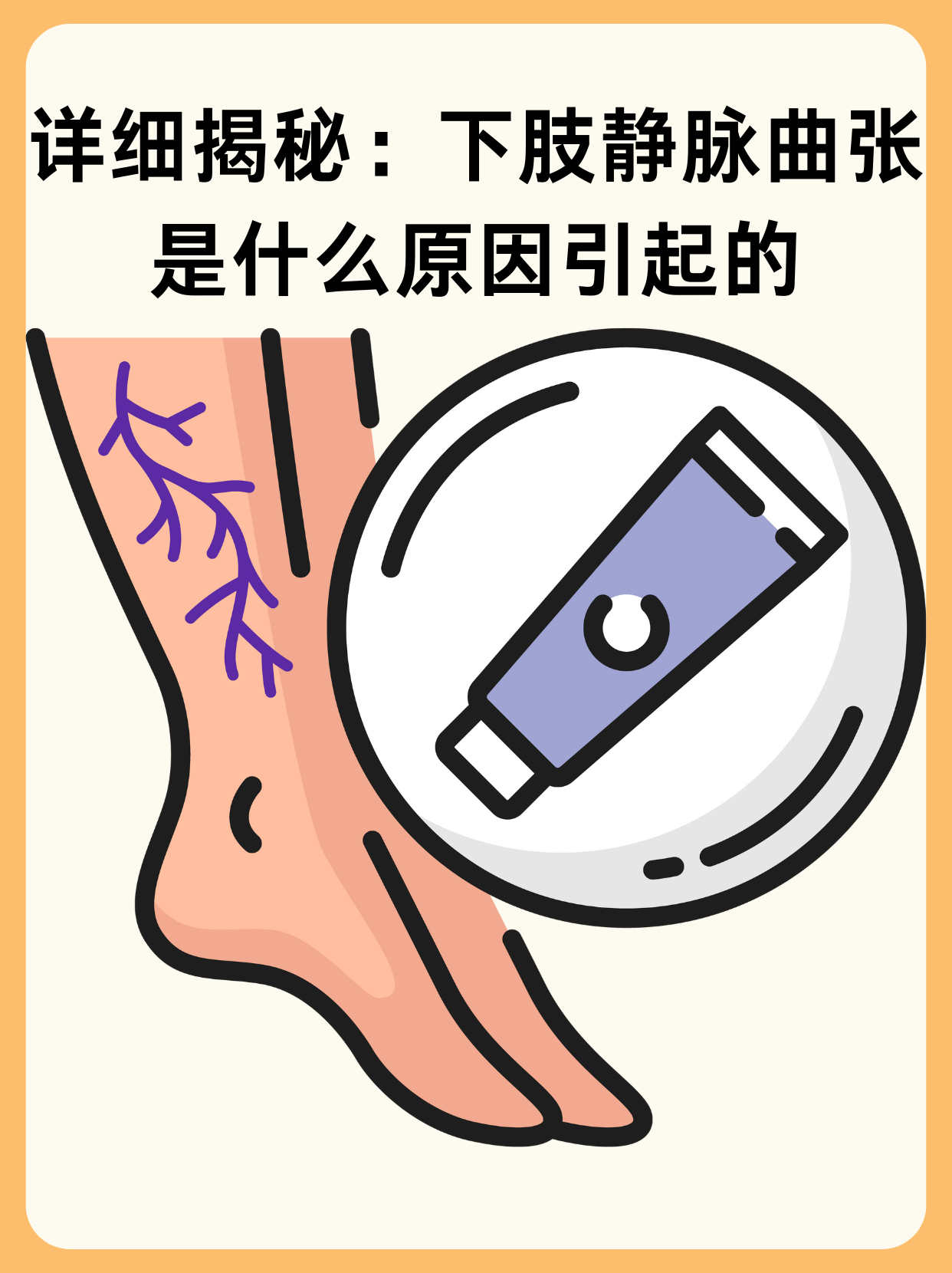 详细揭秘:下肢静脉曲张是什么原因引起的 在日常生活中,下肢静脉曲张