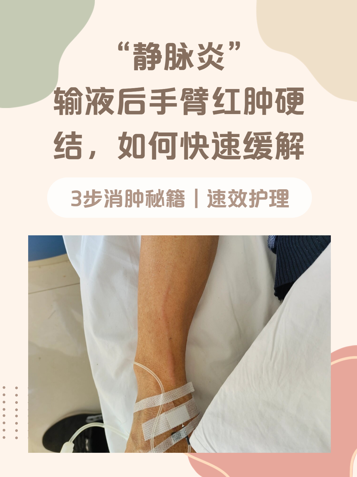 "静脉炎":输液后手臂红肿硬结,如何快速缓解?
