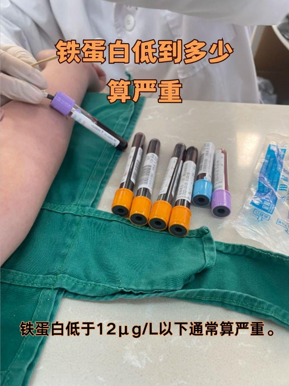 铁蛋白下降要警惕:低到多少算严重?