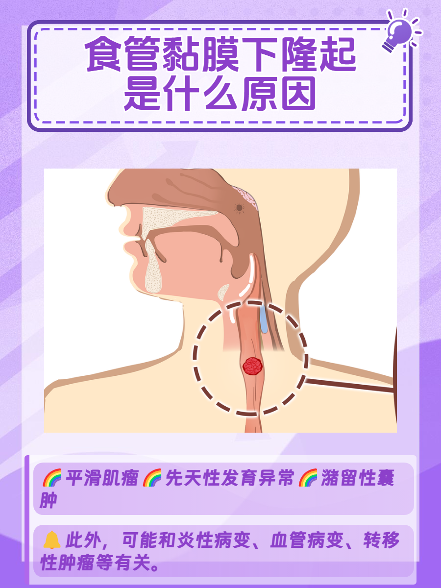 食管粘膜下隆起图片