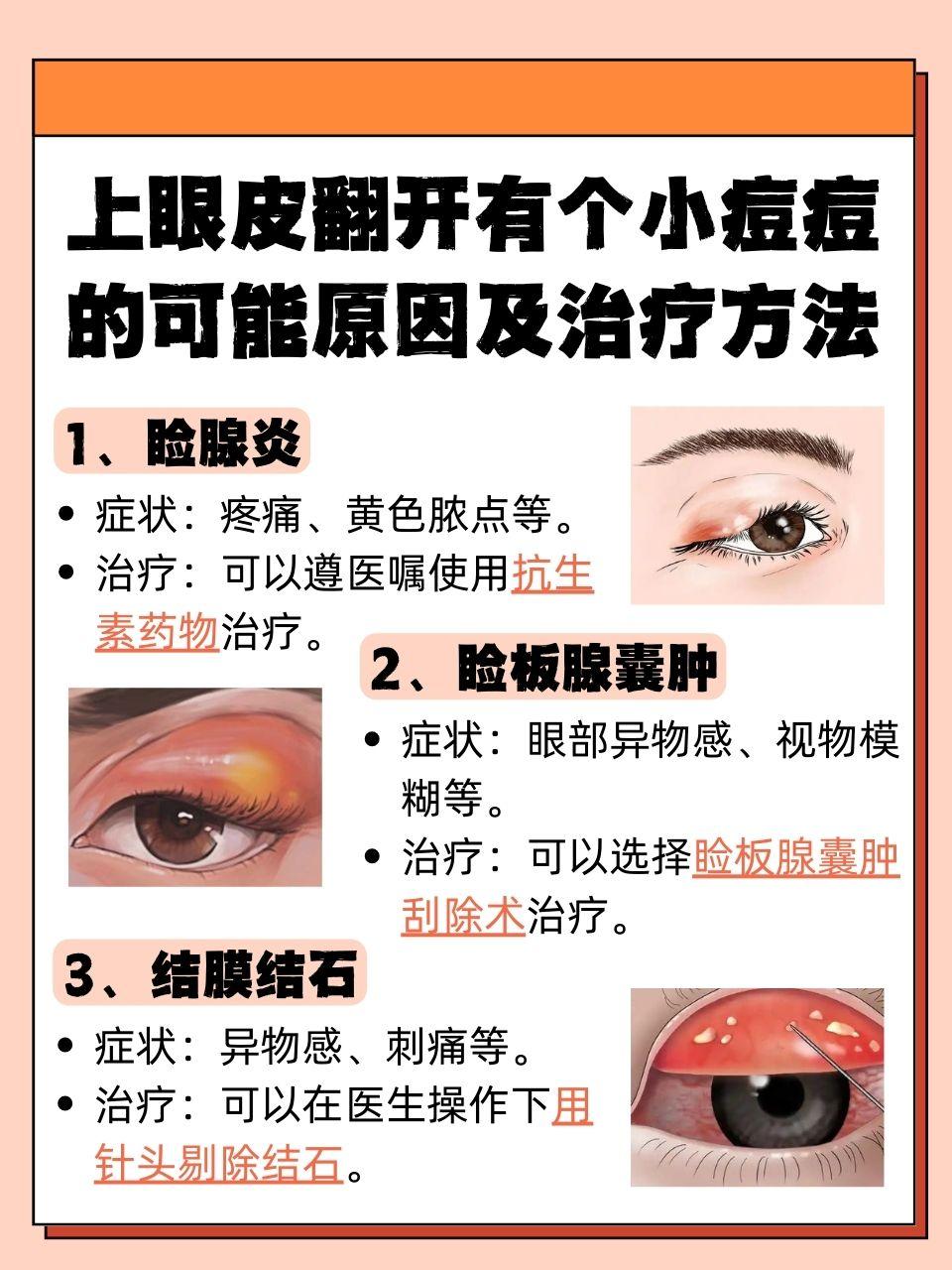 而翻开上眼皮后,发现里面冒出个小痘痘,不仅让人心里犯嘀咕,还时不时