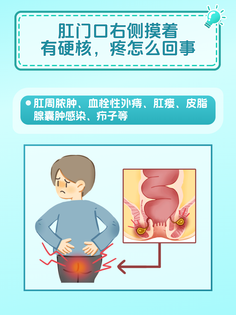 肛门口右侧摸着有硬核,疼怎么回事?