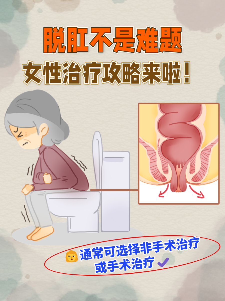 对于女性患者而言,治疗脱肛需要综合考虑症状的严重程度,年龄,生育