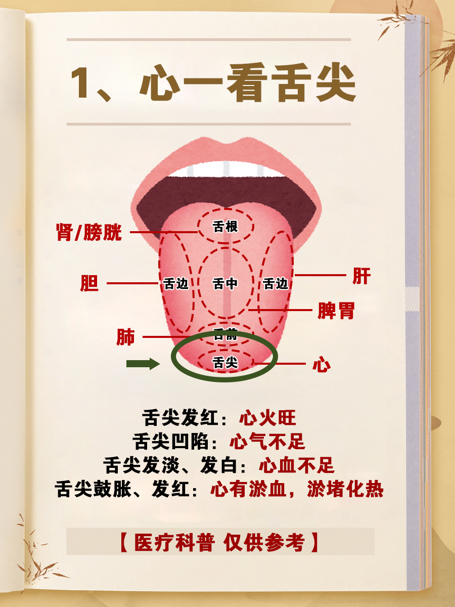 舌诊主要是通过观察舌体的颜色,形状,舌苔等来判断人体内脏的健康状况