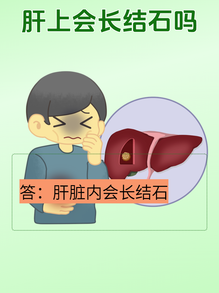 就让我们一起了解肝内胆管结石的神秘面纱吧  首先,需要