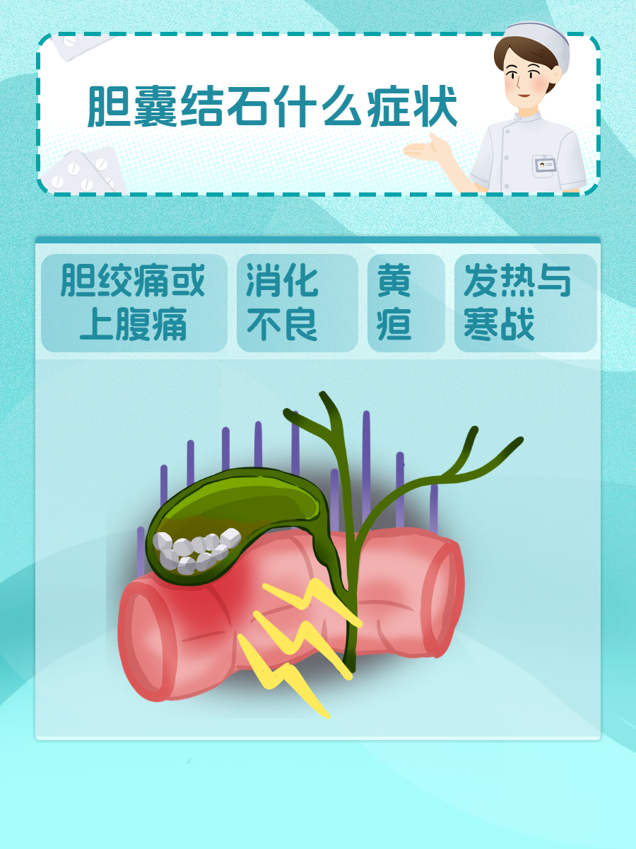 胆囊结石什么症状?