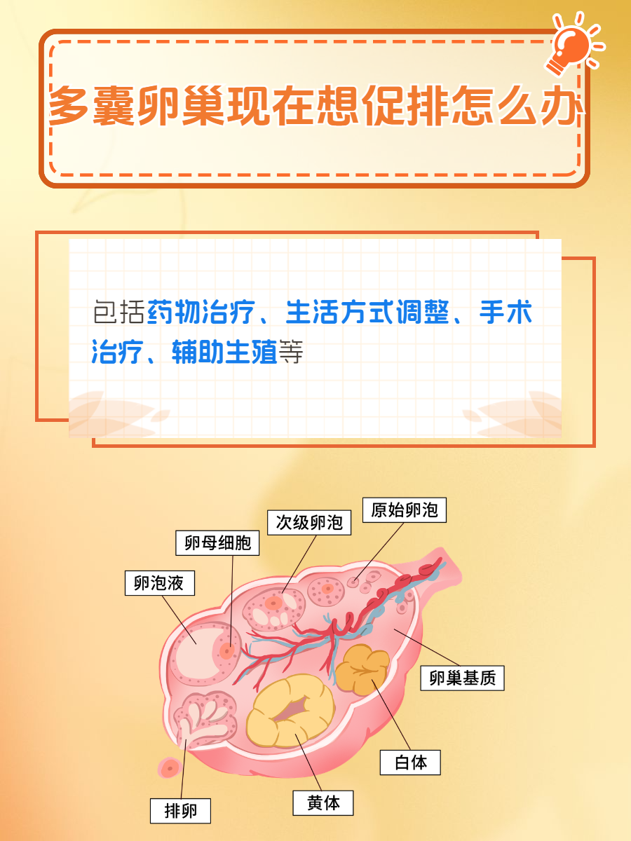 多卵巢多囊综