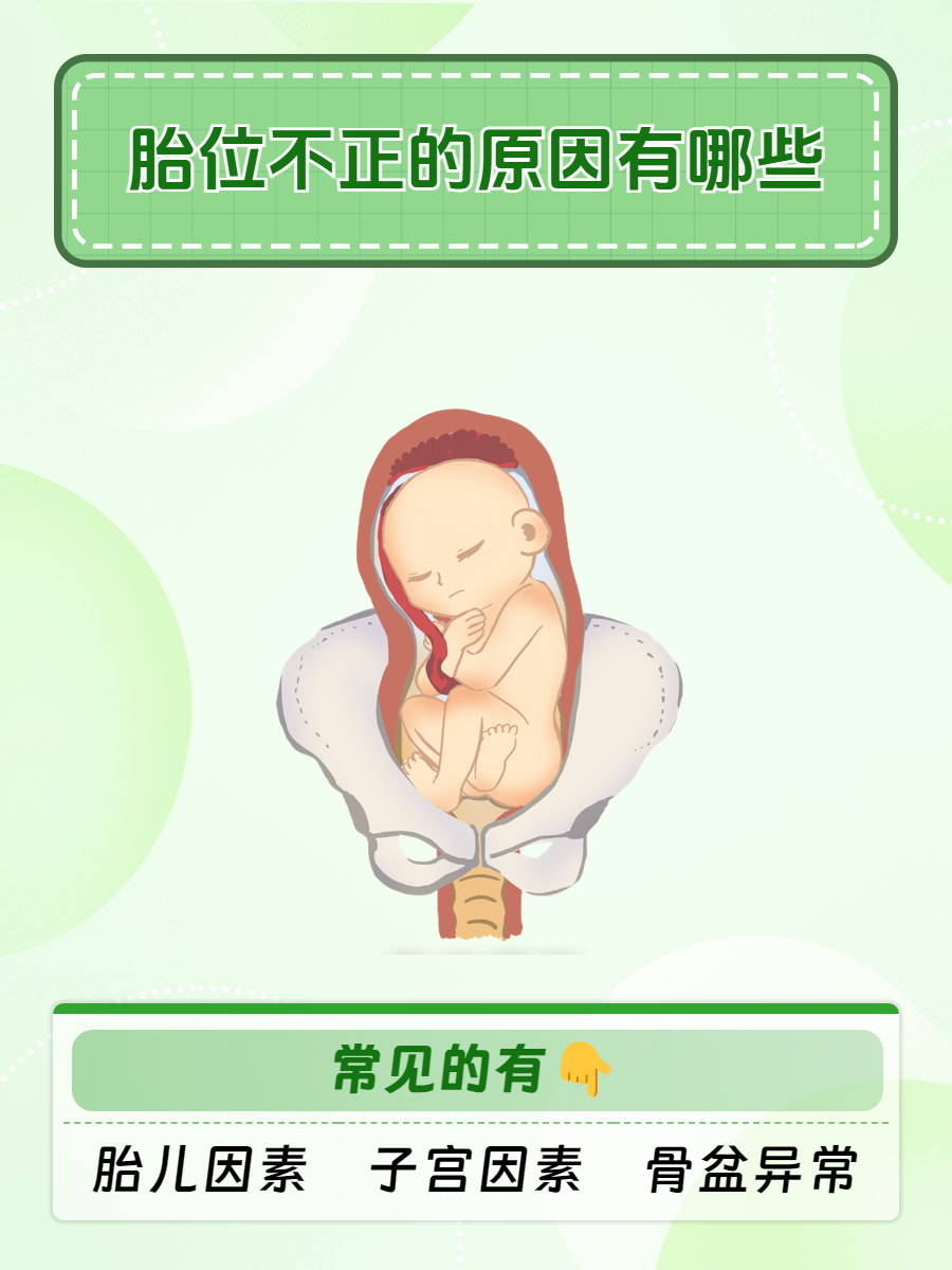 其实引起胎位不正的原因还是比较多的,常见有哪些因素呢?