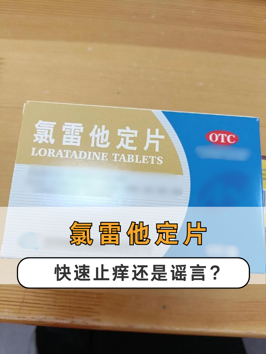 氯雷他定片:快速止痒还是谣言?