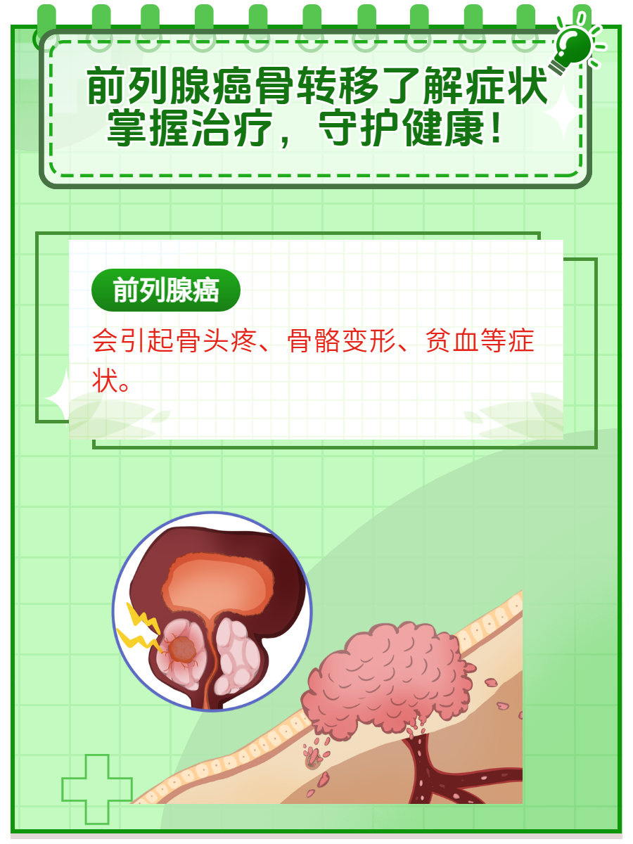 为什么会得前列腺癌