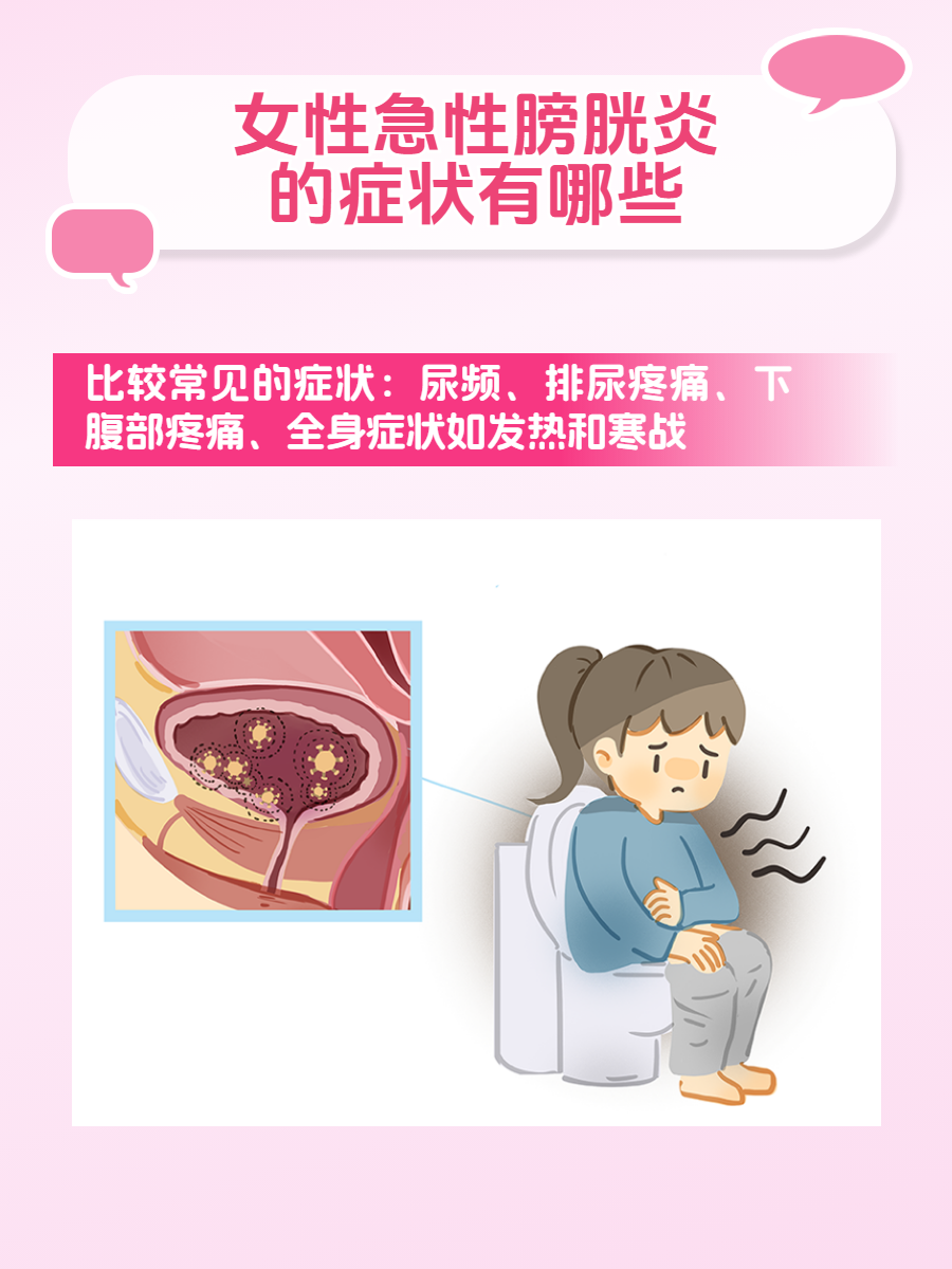 女性急性膀胱炎的症状有哪些?
