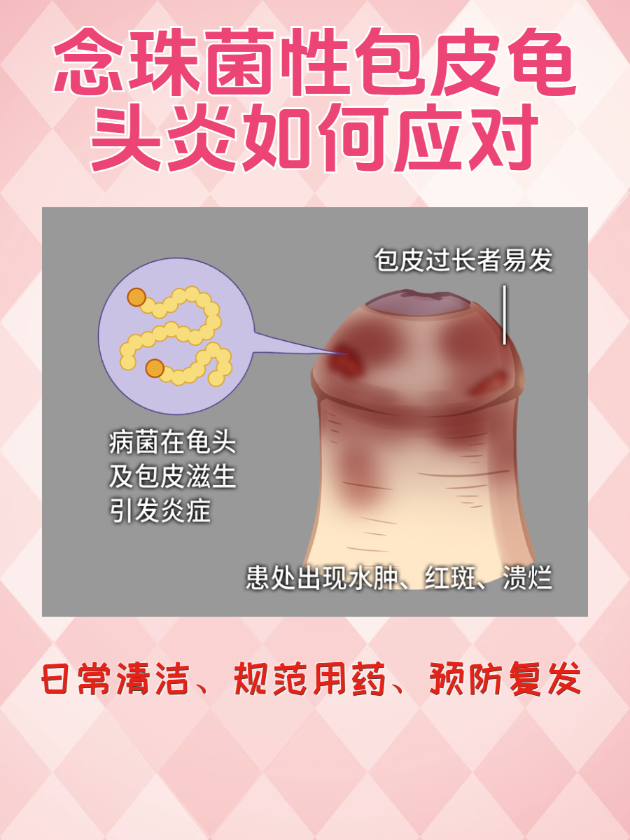 念珠菌性包皮龟头炎怎么治?策略在此!