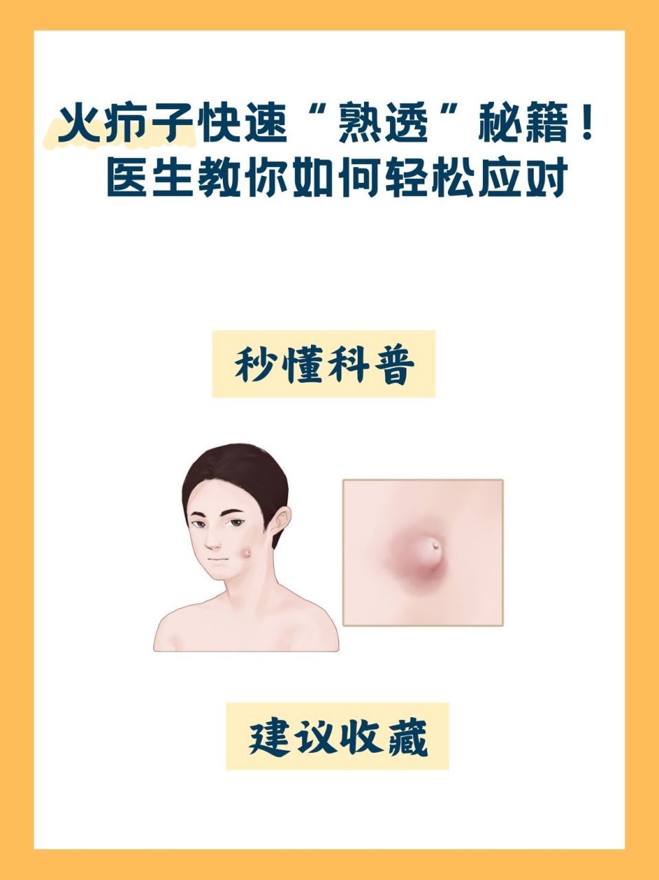 火疖子快速"熟透"秘籍!
