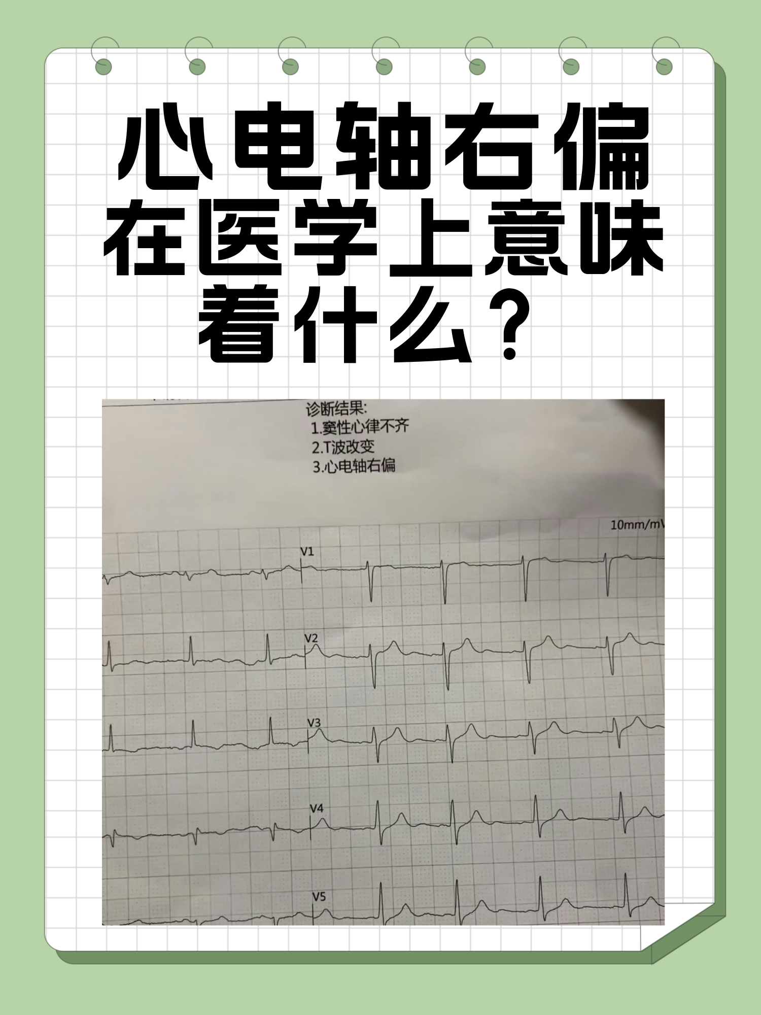什么是u电(什么是ul认证)