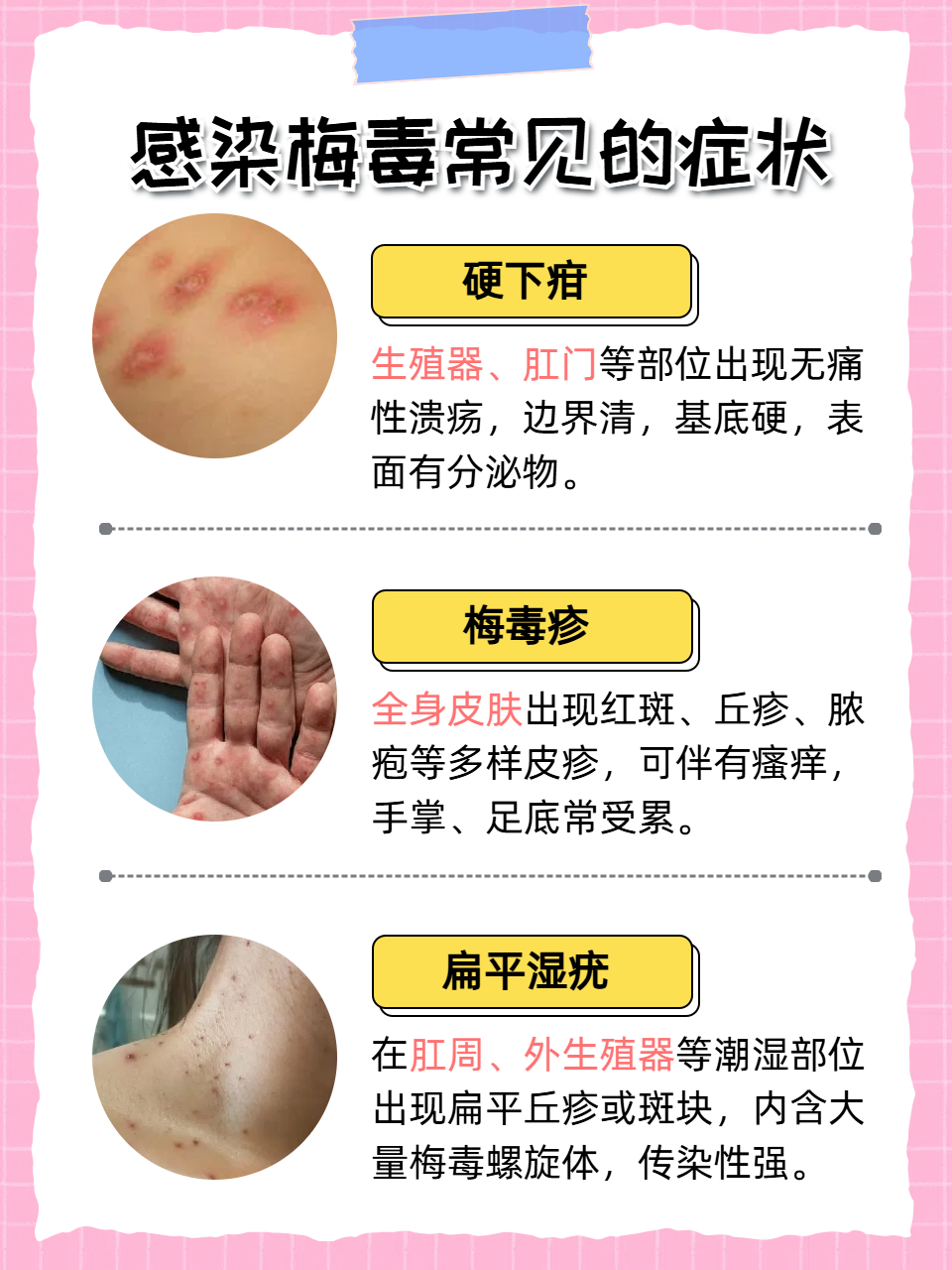 为什么会感染梅毒和HPV为什么在线 为什么会感染梅毒和HPV为什么在线