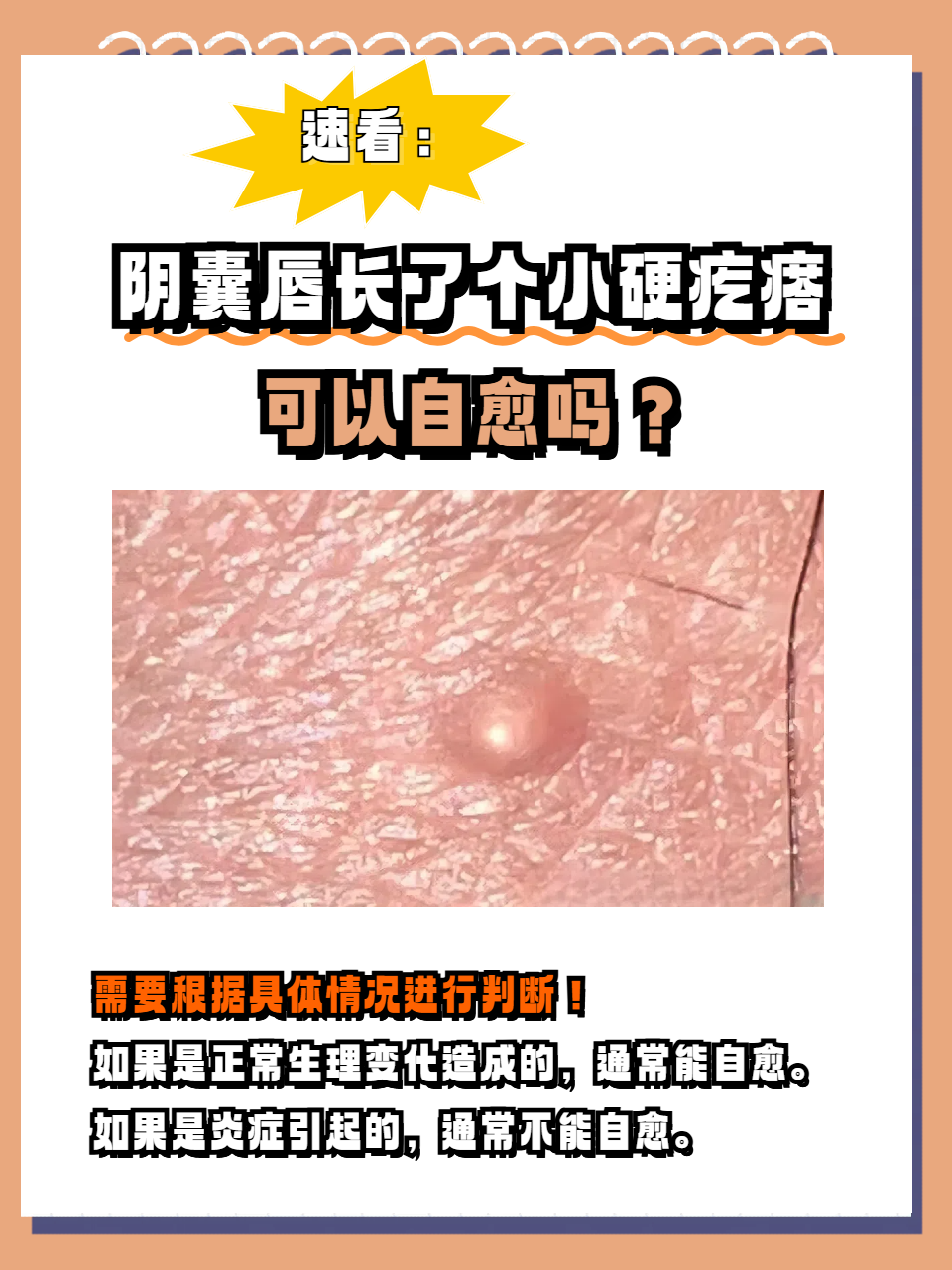 阴囊唇长了个小硬疙瘩可不可以自愈