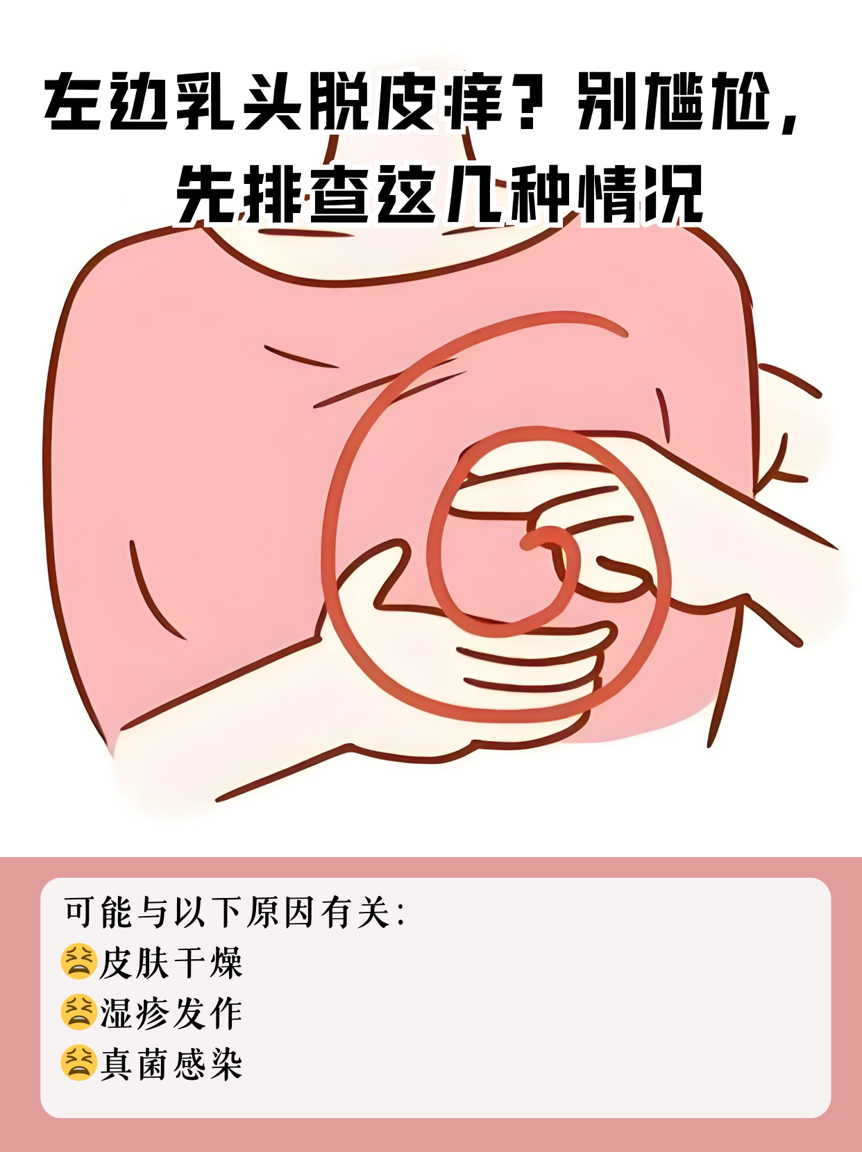 左边乳头脱皮痒?