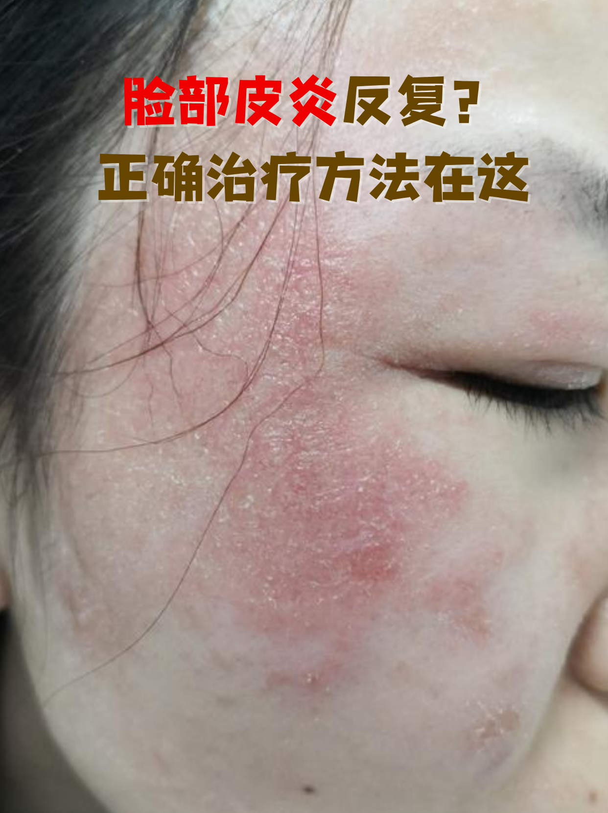 为什么脸上会痒 为什么脸上会痒