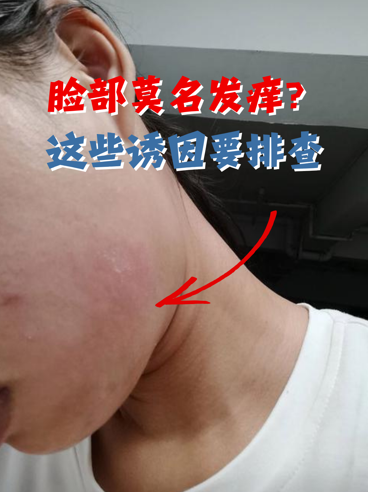 脸上为什么痒