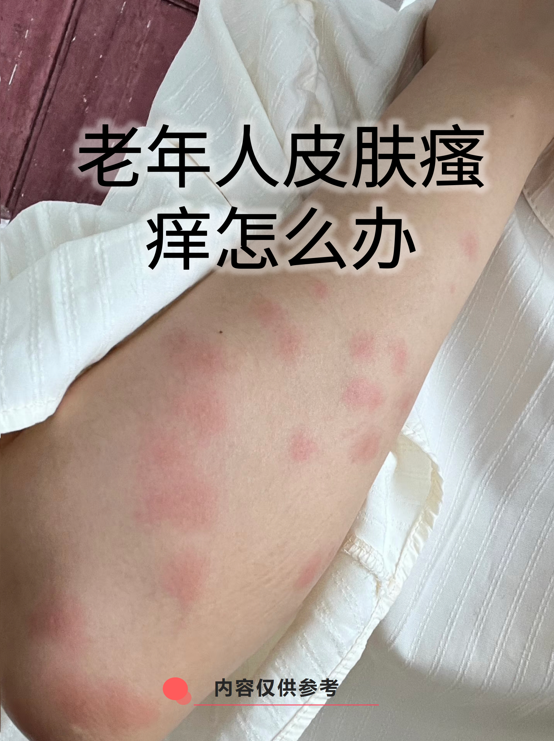 老年人皮肤瘙痒怎么办