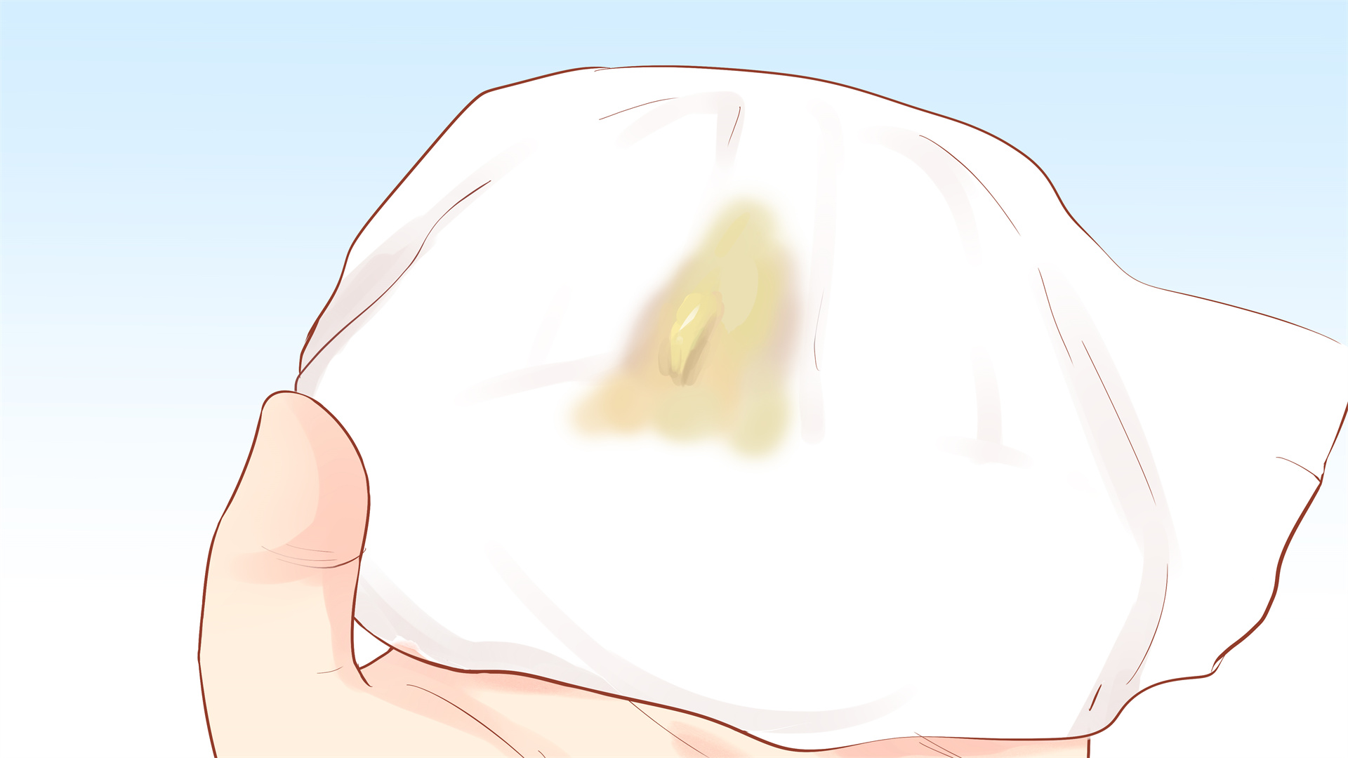 从症状表现来看,如果白带量明显增多,质地清稀如水样,或黏稠如豆腐渣