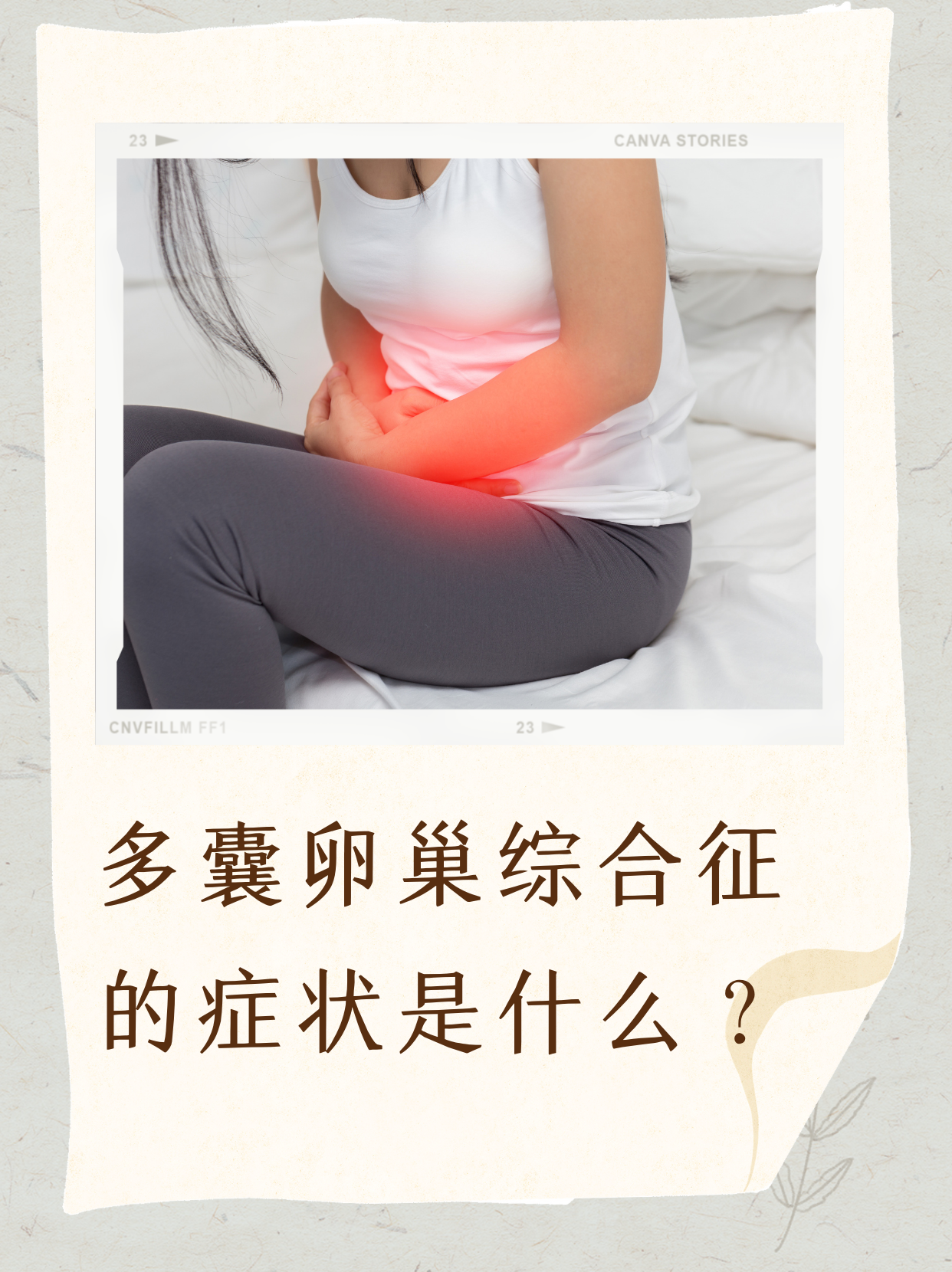 pcos卵巢多囊(pcos多囊卵巢综合征最常见并发症)