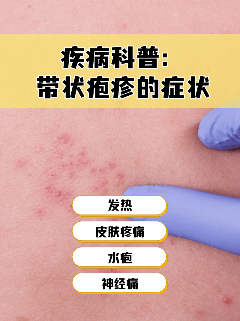  最近病毒感染有什么症状(最近病毒感染有什么症状表现吗)