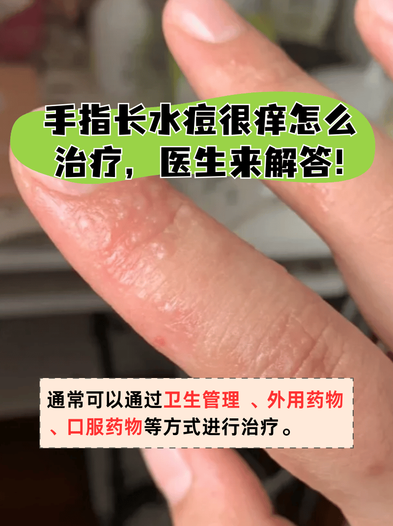 为什么手很痒