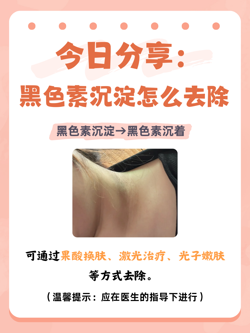 为什么会晒黑怎么恢复为什么在线 为什么会晒黑怎么恢复为什么在线