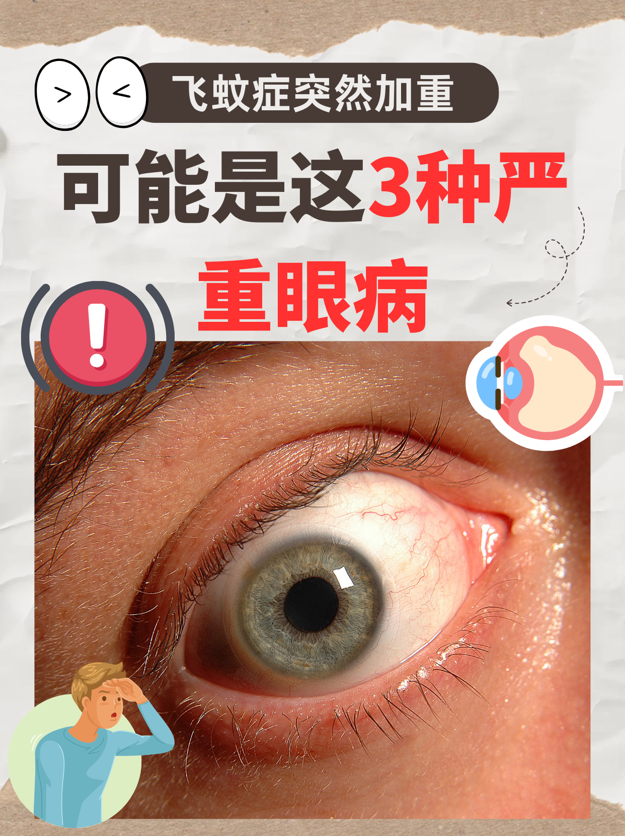 可能是这3种严重眼病
