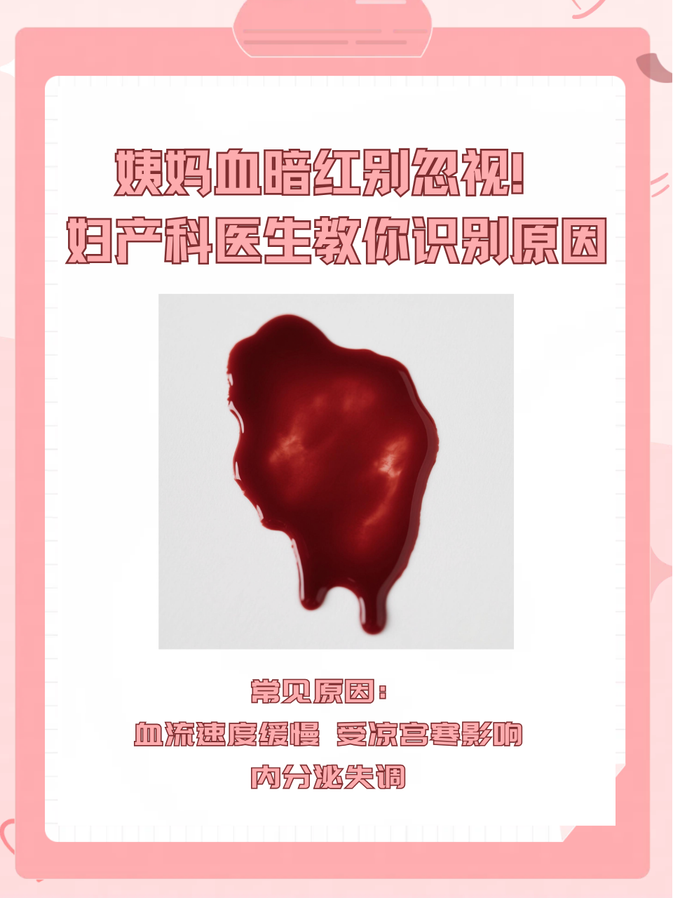 妇产科医生教你识别原因