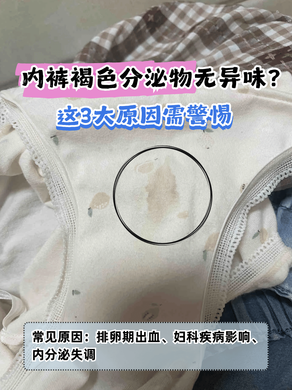 内裤褐色分泌物无异味?