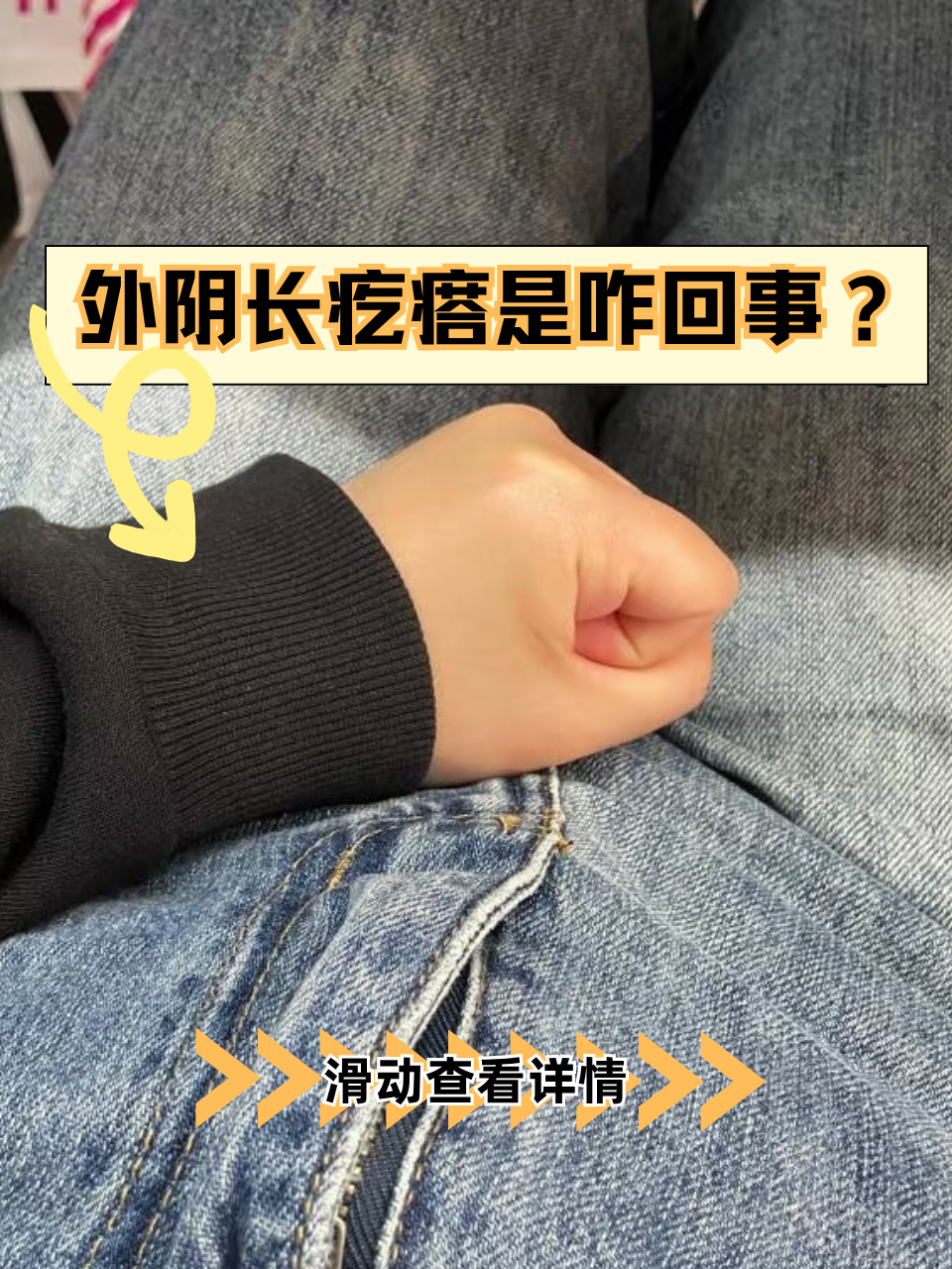发现外阴冒出小疙瘩,不少人瞬间慌了神,既尴尬又担心!