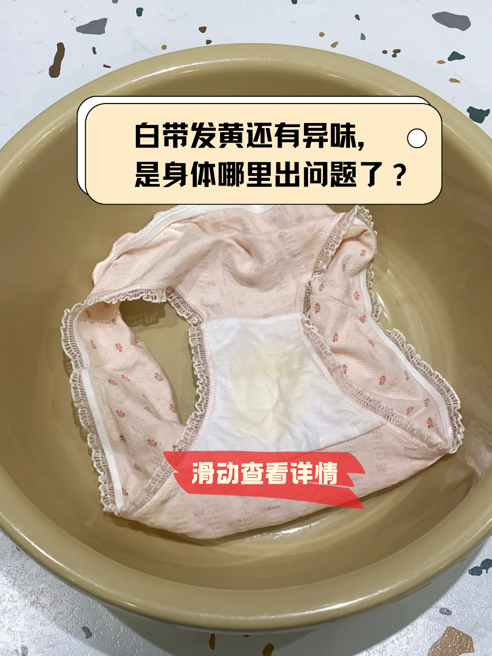 突然发现白带发黄,还带着一股难闻异味?别不当回事!